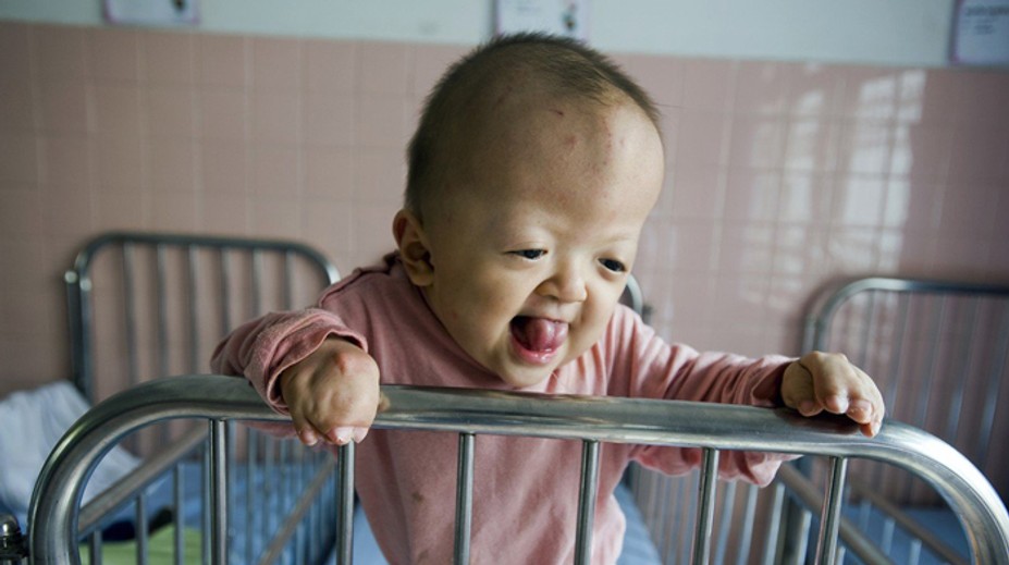 Deti Agenta Orange. Toto sú katastrofálne následky aj po 45 rokoch od vietnamskej vojny