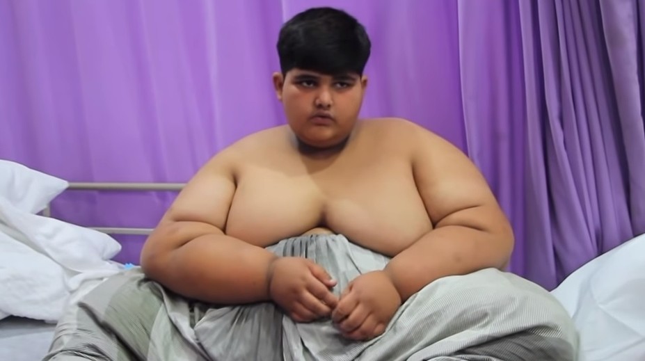 Najtučnejšie dieťa na svete: Má 10 rokov a takmer 200 kilogramov
