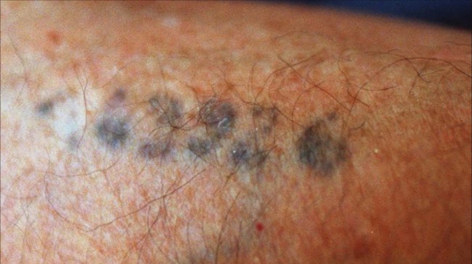 Väzňom tetoval čísla: Krutý príbeh žida z Krompách obletel svet