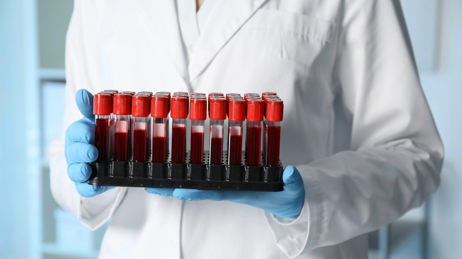 Príčina smrti rodiny, ktorá zomrela počas dovolenky, bola dlho záhadou. Desivú pravdu odhalili laboratórne testy