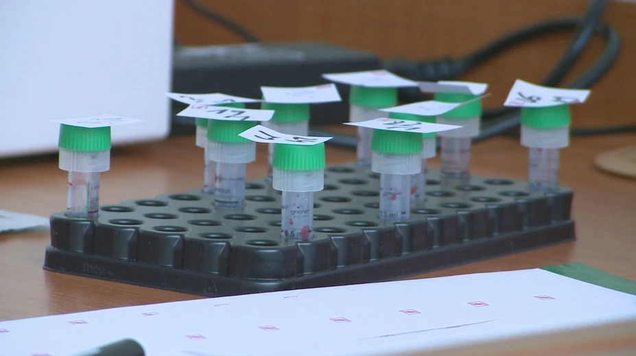 HIV sa čoraz častejšie šíri medzi heterosexuálmi. Pozreli sme sa na situáciu na Slovensku