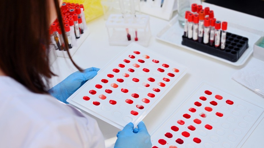 Vedci objavili novú krvnú skupinu. Zatiaľ je jej nositeľkou jediná žena na celom svete