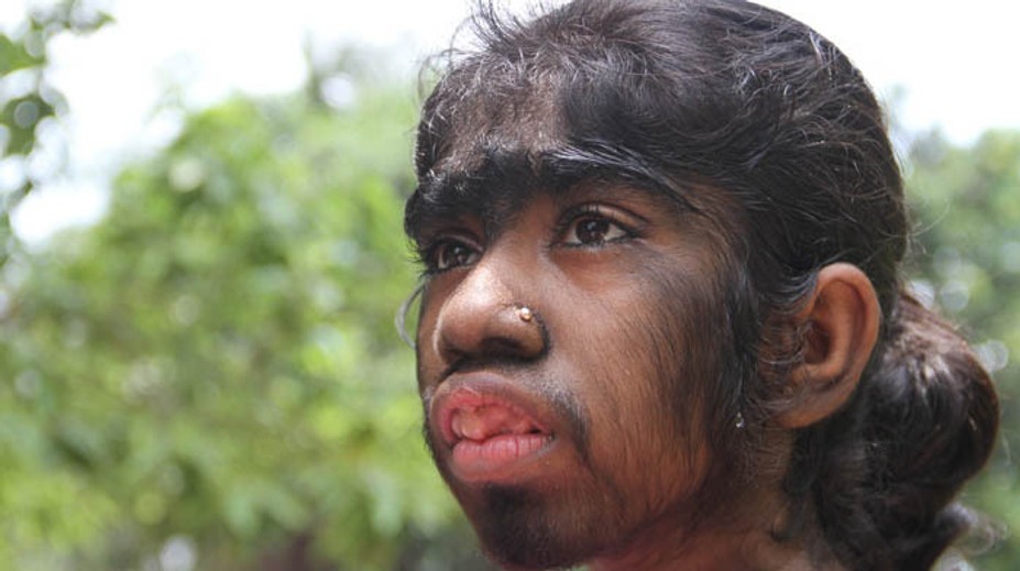 Je v najkrajšom veku, ale musí sa schovávať. Vyzerá ako vlčie dieťa