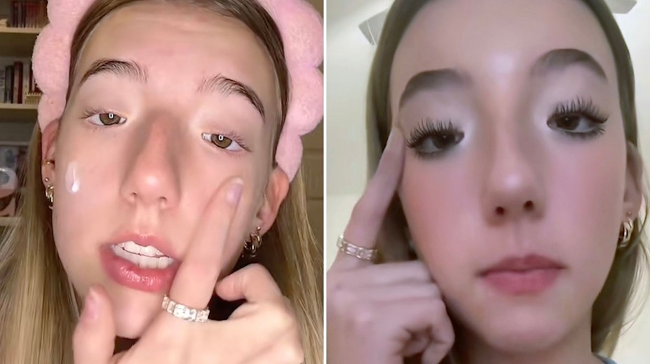 Narodila sa bez dôležitého svalu v tvári a tri roky nevedela žmurkať. Za jej výzor ju šikanovali v škole aj na pracovisku