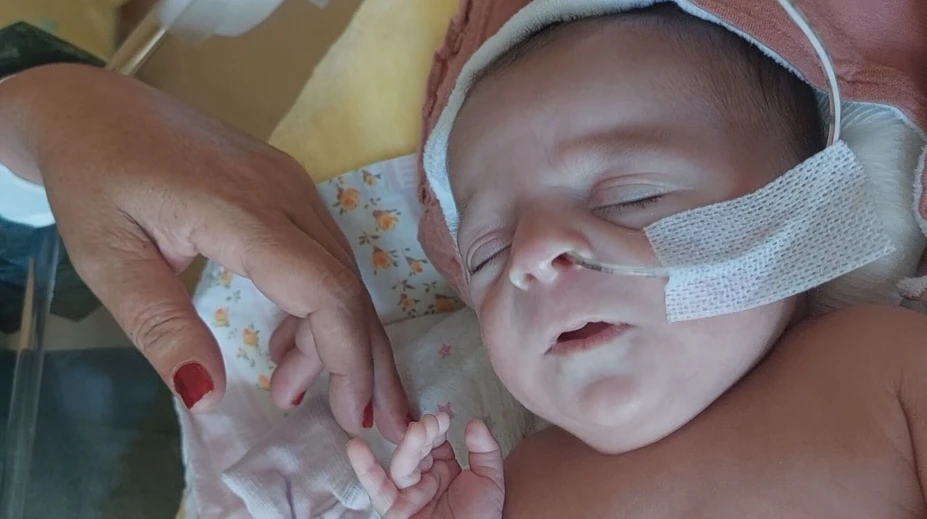 Siamské dvojčatá presunuli z Bratislavy. Lekári prezradili, ako sa dievčatám darí
