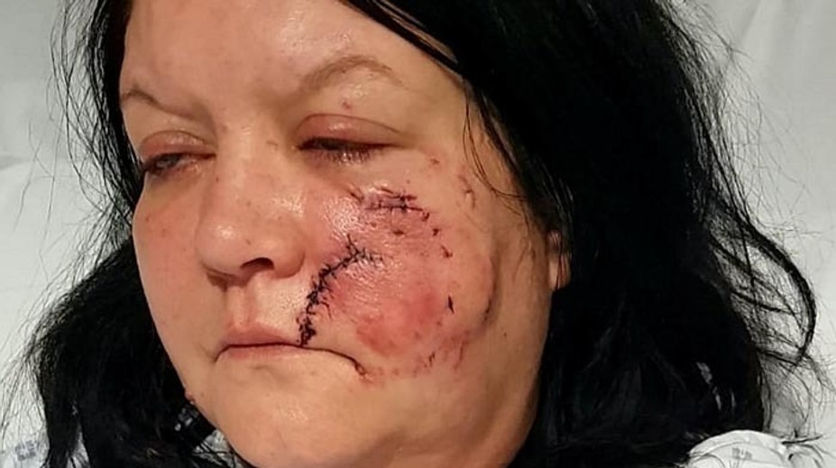 Ženu brutálne zmasakroval pes. Nekonečných 45 minút sa Rachel obávala, že zomrie