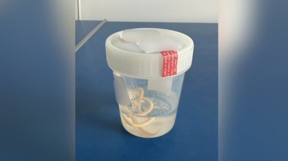 Tlak na hrudi či dýchavičnosť nemusia znamenať len problémy so srdcom. Klinika upozorňuje na kuriózny prípad