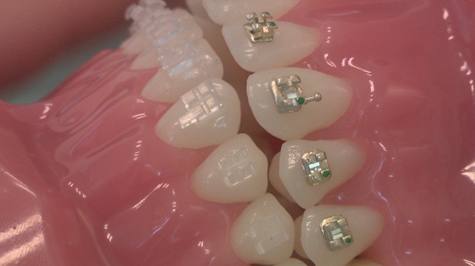 Dajte si pozor, kto vám robí zubný strojček. Pre peniaze to robia aj lekári, ktorí na to nemajú vzdelanie