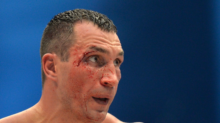 Vladimir Kličko odvolal súboj s Anthonym Joshuom