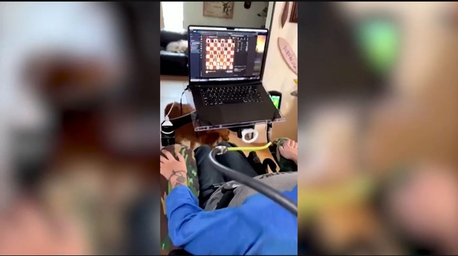 VIDEO: Pacient, ktorý má v mozgu čip od Neuralinku, hral šach na počítači len pomocou mysle