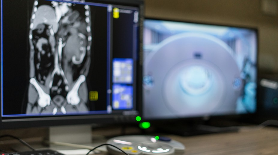 S cudzím predmetom v tele žila šesť rokov: Zabudli jej ho tam pri cisárskom reze