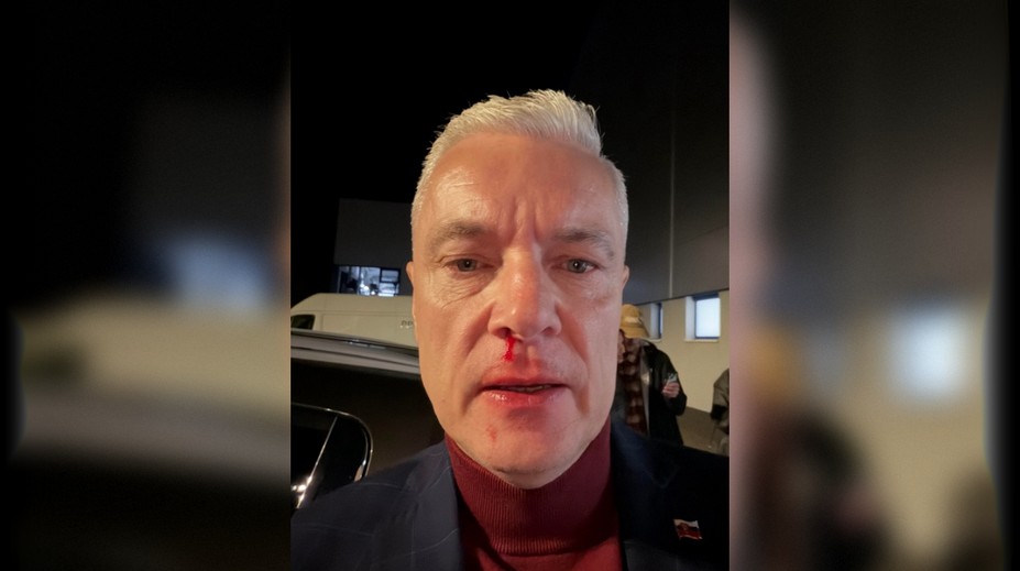 Ferenčák po útoku skončil na pohotovosti. Polícia začala stíhanie, hľadá svedkov