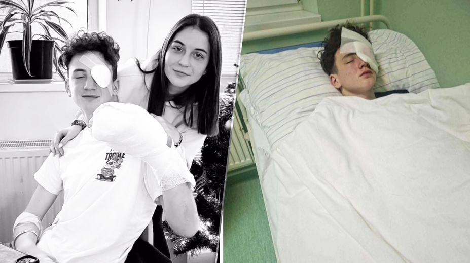 Martin (15) z Oravy prišiel na Silvestra o oko a tri prsty. Na vine bola pyrotechnika