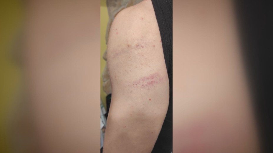 Tínedžer spod Tatier prišiel z mikulášskej akcie s modrinami. Palicou ho mal dobiť čert