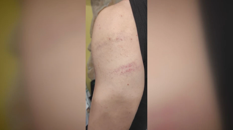 Tínedžer spod Tatier prišiel z mikulášskej akcie s modrinami. Palicou ho mal dobiť čert