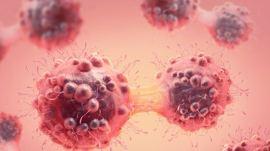 Toto sú kľúčové faktory, ktoré vedú k vzniku rakoviny u mladých ľudí