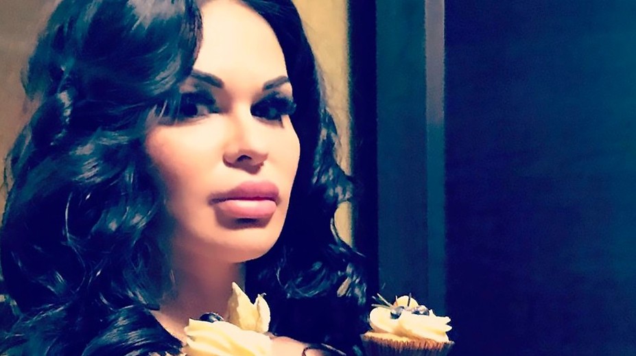 Má ich obrovské! Do pŕs si pichá kyselinu hyalurónovú, aby vyzerala prirodzene