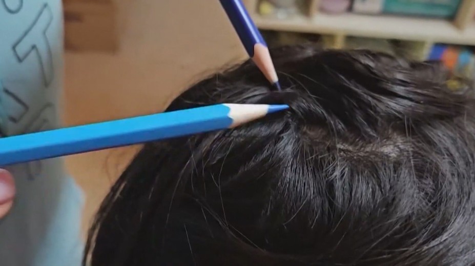 So všami si v Dobšinej nevedeli rady, pomohli občianske združenia a špeciálne šampóny