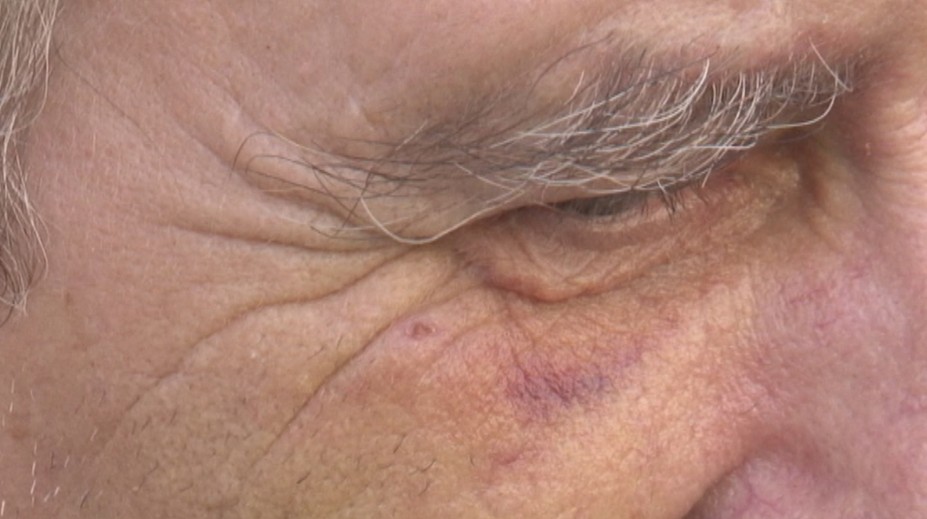 Mladíci zbili dôchodcu, pretože im nedal cigaretu. Ešte ho aj okradli