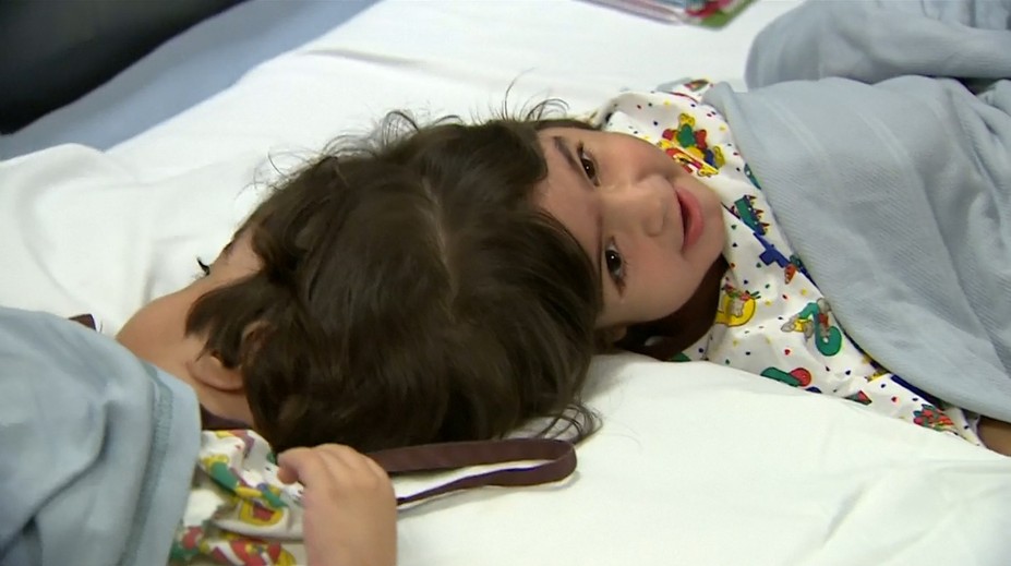 Zázrak v londýnskej nemocnici: Stovka lekárov oddelila hlavou zrastené dievčatá