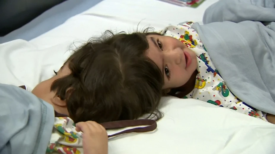 Zázrak v londýnskej nemocnici: Stovka lekárov oddelila hlavou zrastené dievčatá