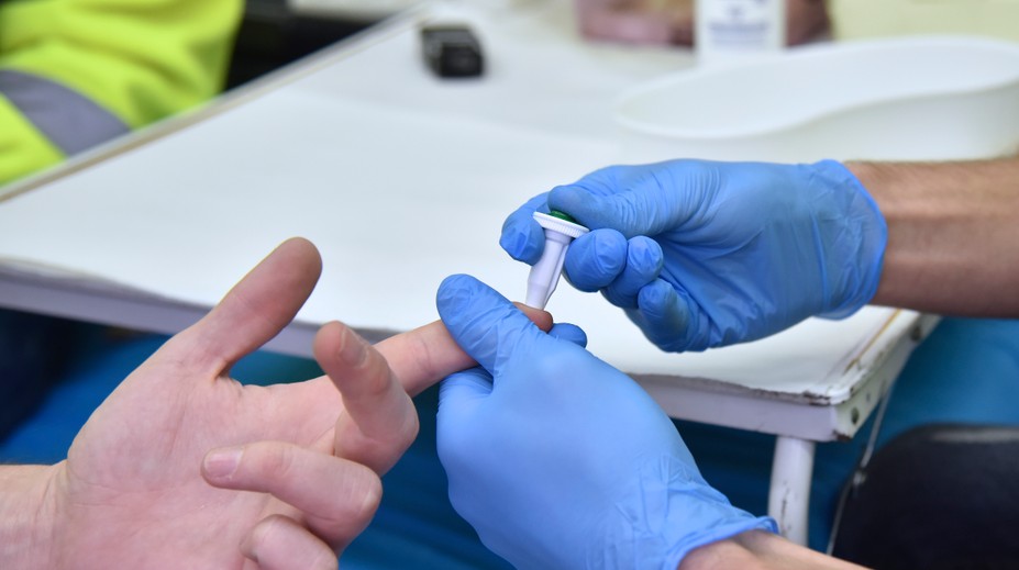 Verejnosť sa môže otestovať na vírusové ochorenia v 11 slovenských mestách