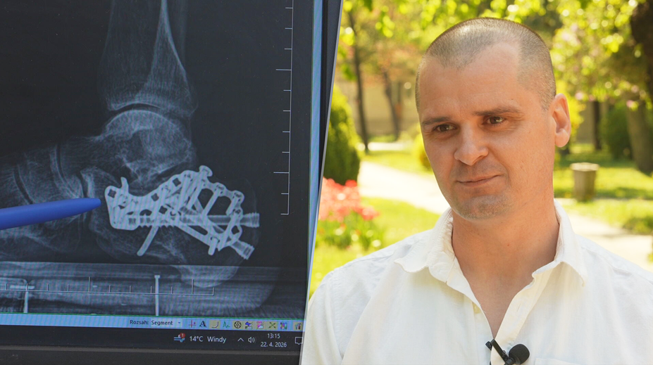 Karol prežil desivý pád z 30 metrov. Pri záchrane jeho života sa však pozabudlo na komplikovanú zlomeninu