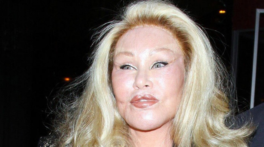 Mačacia žena tvrdí, že nikdy nepodstúpila plastiku. A toto je čo?