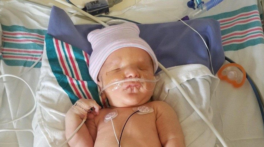 Chlapček nikdy neuvidí, ako vyzerá. Narodil sa bez očí