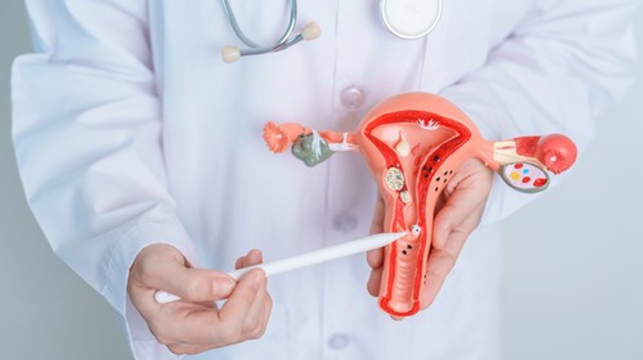 Neinvazívne odstránenie myómov maternice? Inovatívna liečba už je dostupná aj na Slovensku