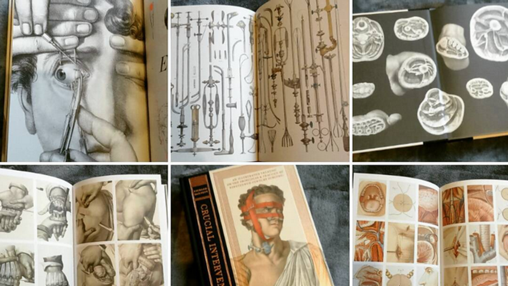 Crucial Interventions