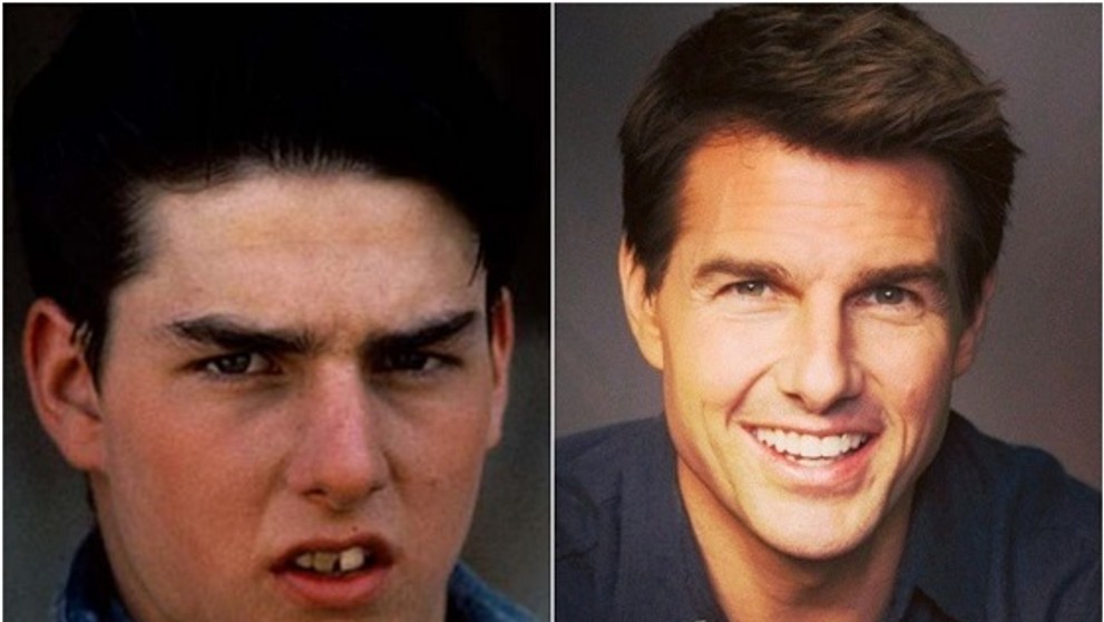 Tom Cruise