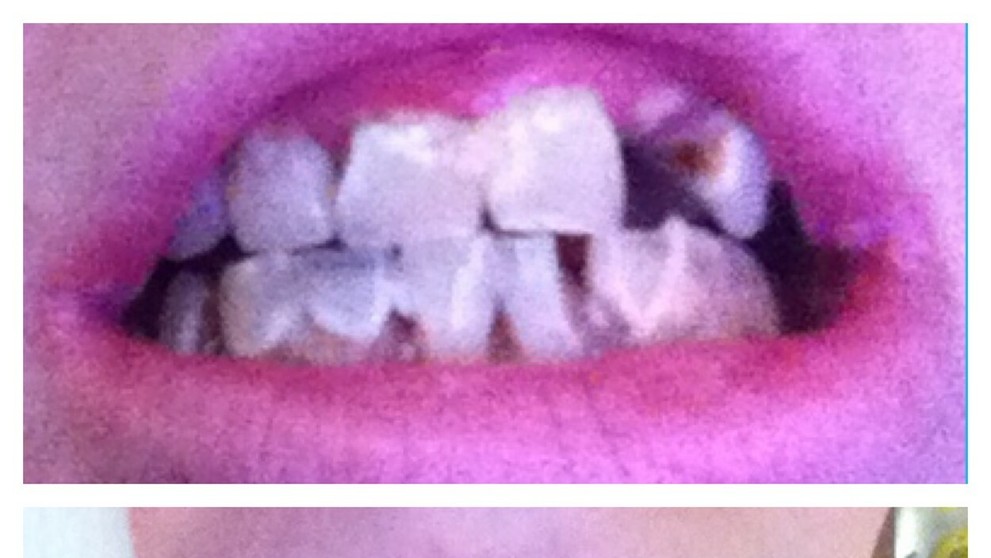 Skye Simpsons prišla o zuby.