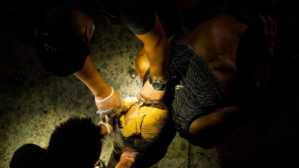 Znetvorená mŕtvola oblepená páskou