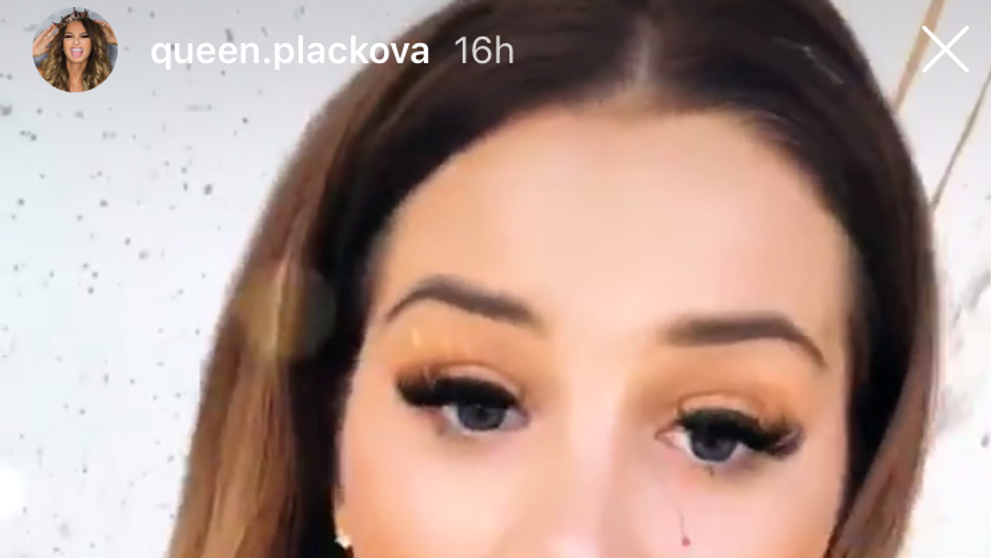 Zuzanu Plačkovú doškriabalo tigrie mláďa. 