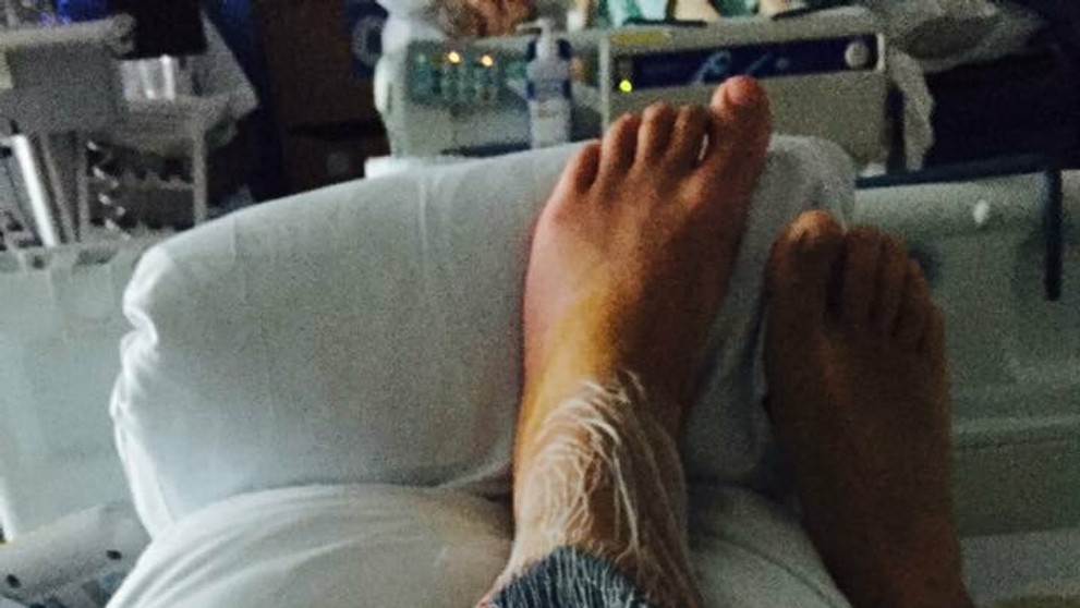 Lewisovi Brownovi museli vyrezať z nohy sval.