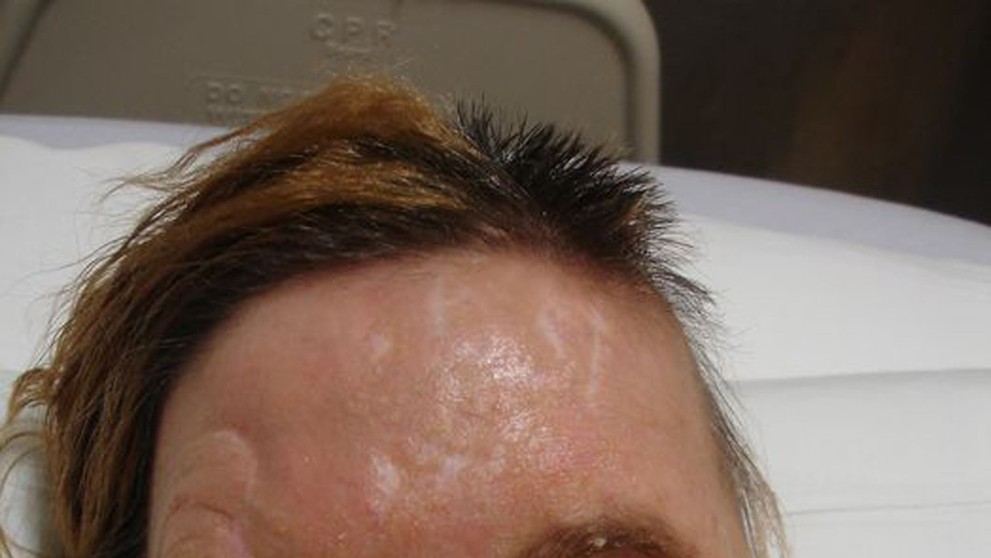 Na ženu zaútočil šimpanz.