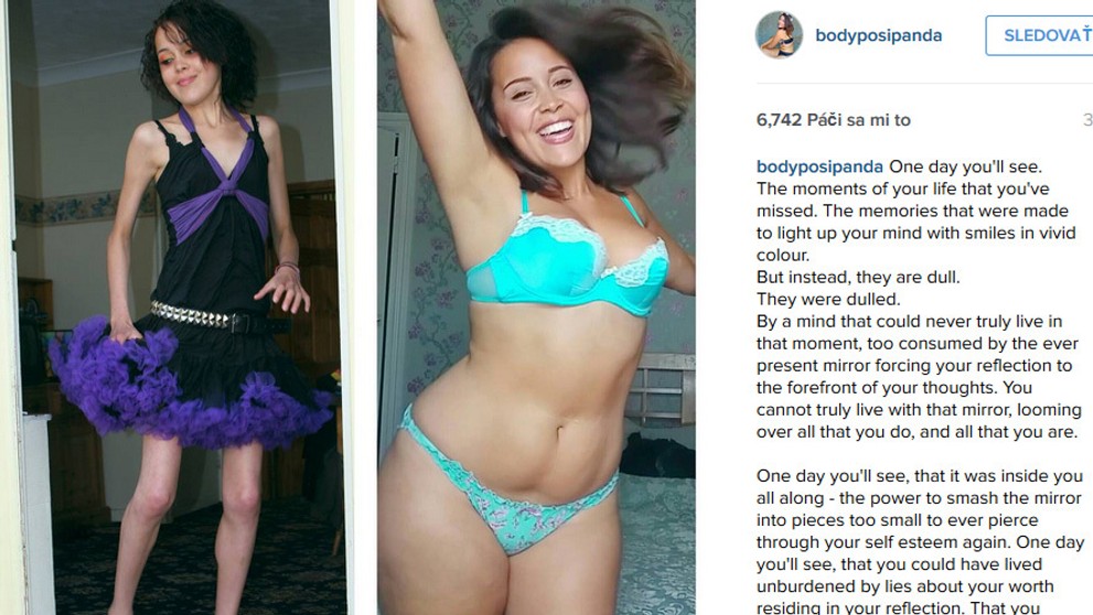 Megan Jayne predtým a teraz.