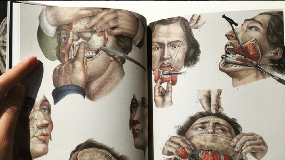 Crucial Interventions