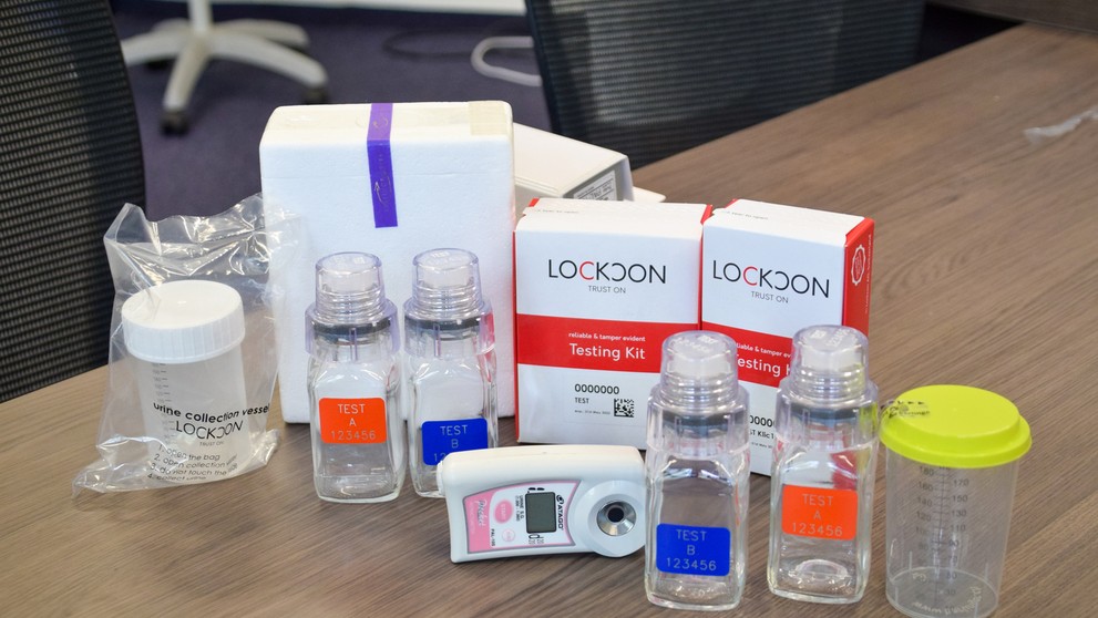 Pohárik na odober moču, ktorého vzorka sa zapečatí aj do sklenených fľašiek. Vzorky smerujú na analýzu a odkadajú sa aj na dobu 