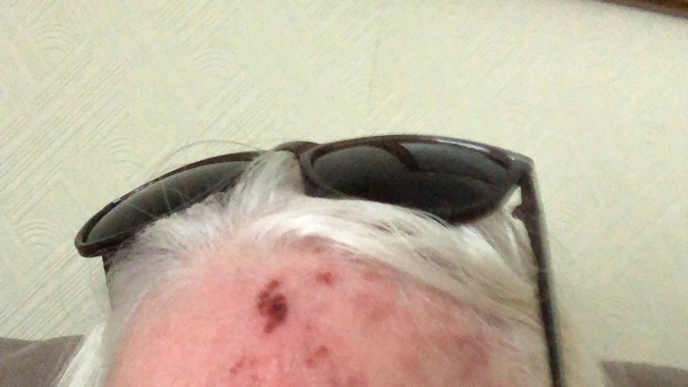 Reakcia Jean Hill na slnko.