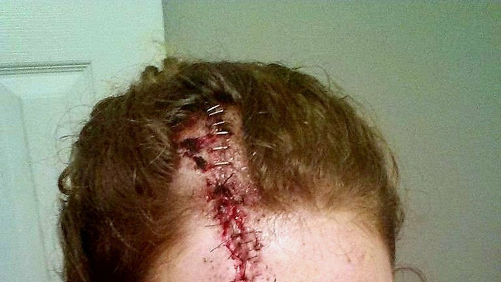 Marisha po operácii