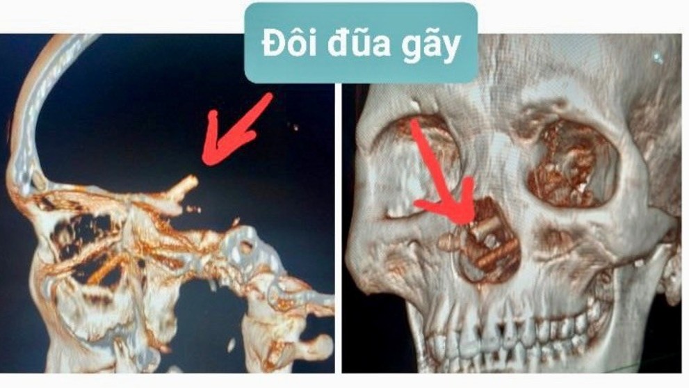 Snímka z počítačového tomografu.