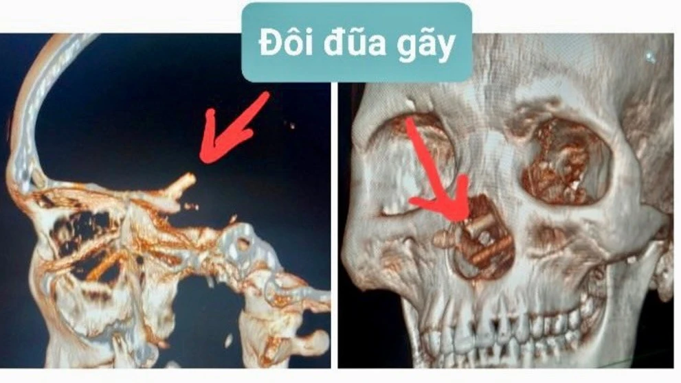 Snímka z počítačového tomografu.