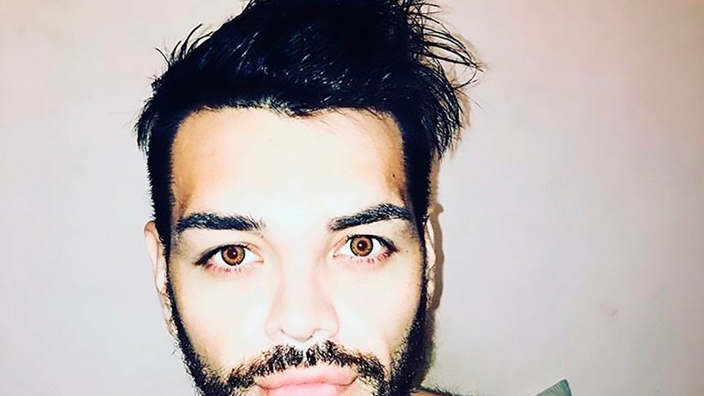 Fran Mariano si nechal napichať pery