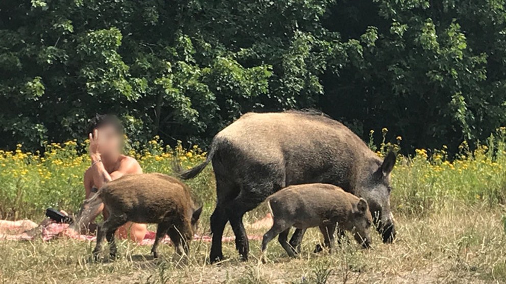 Žena pre obezitu podstúpila operáciu žalúdka. Po nej takmer prišla o život