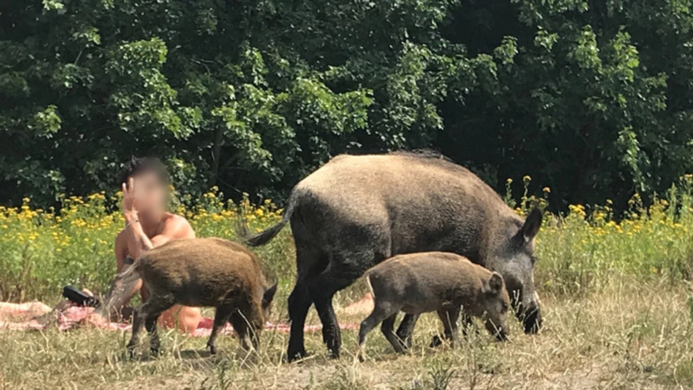 Žena pre obezitu podstúpila operáciu žalúdka. Po nej takmer prišla o život