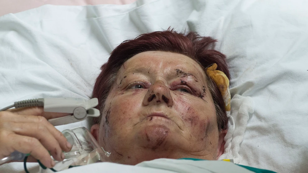 Zranená turistka Helena z okresu Trebišov zostáva hospitalizovaná v Centrálnej klinike v srbskom meste Niš.
