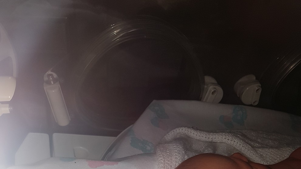 Hlavička malej Izabelke po páde veľmi opuchla.