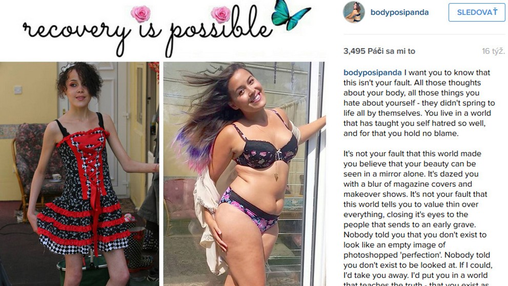 Megan Jayne predtým a teraz.